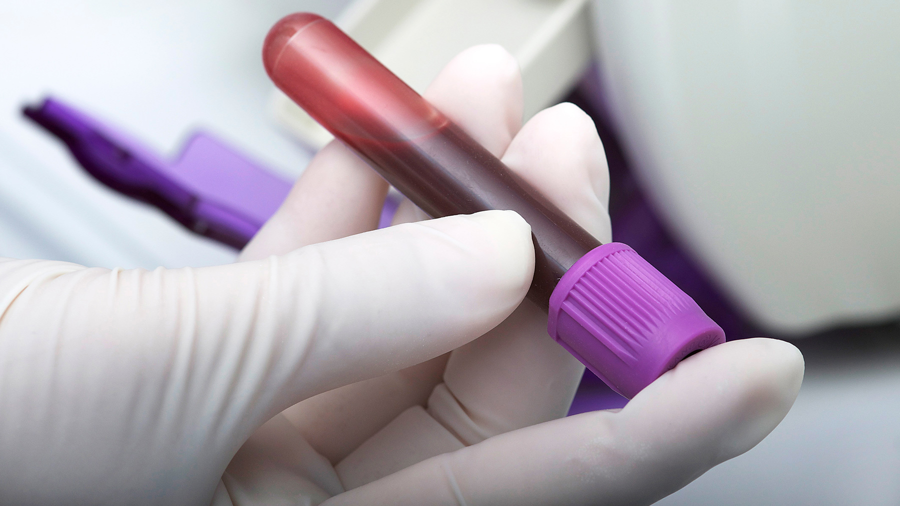 bloodtest_large