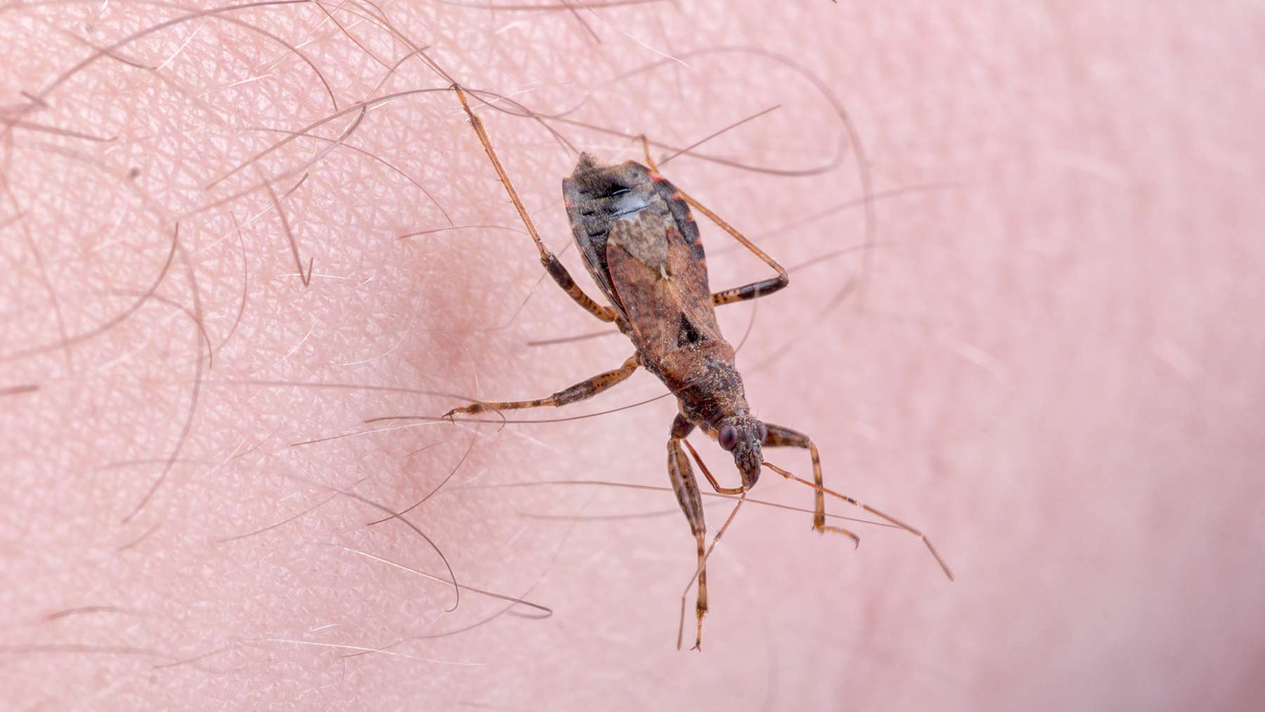 Chagas-disease_large