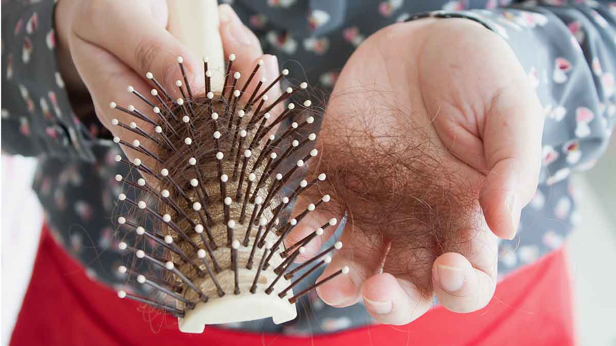 alopecia_small