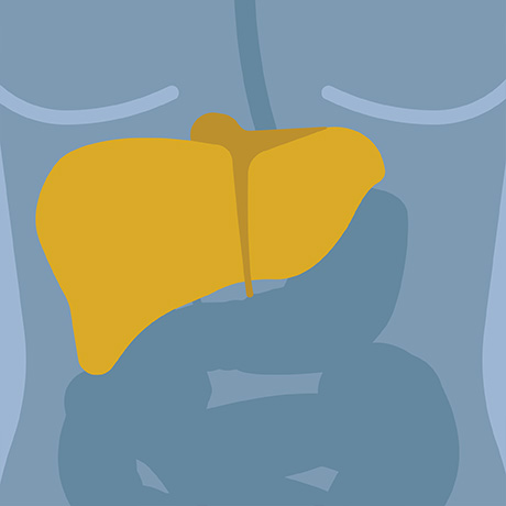 LiverTransplant