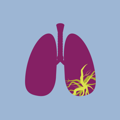 Lung icon depicting chronic pulmonary infection