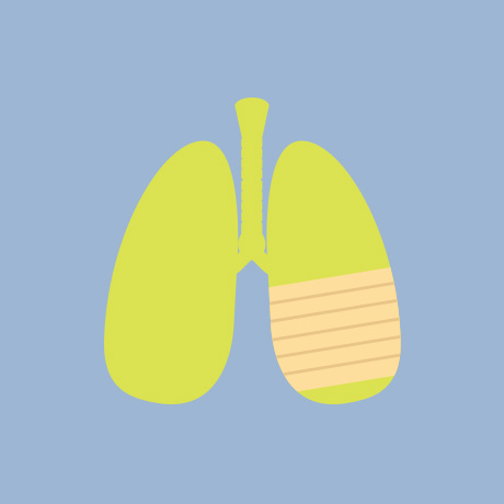 Lung icon depicting pulmonary rehabilitation