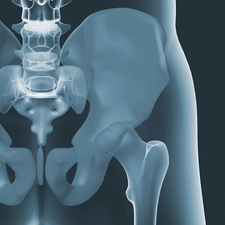 Bones of the hip