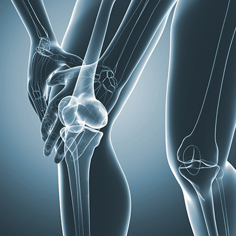 Bones of the knee