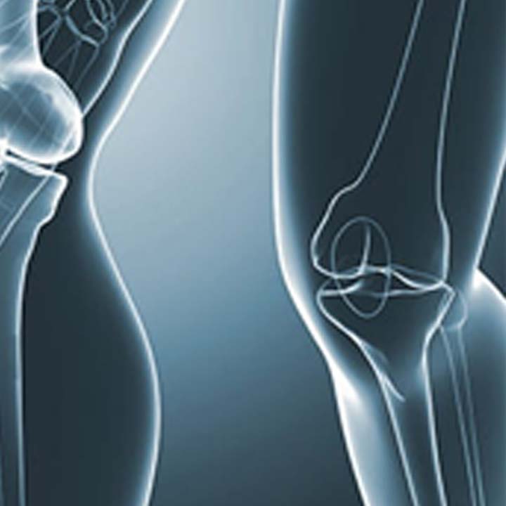 Bones of the knee