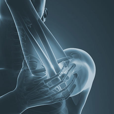 Bones of the forearm