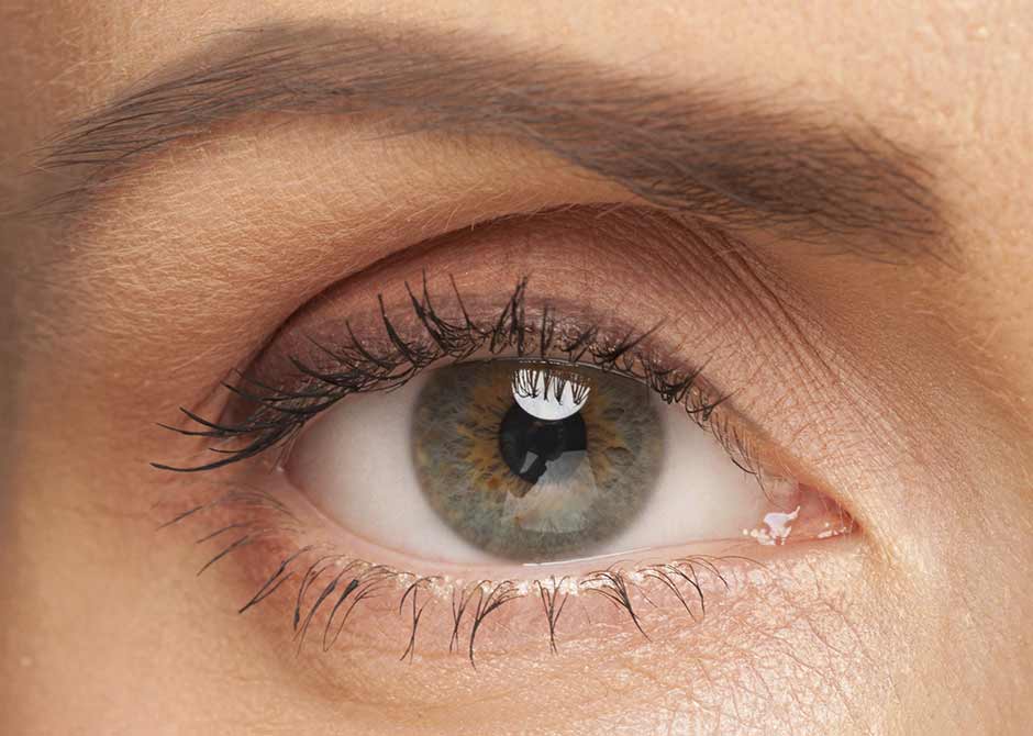 EyelidSurgery
