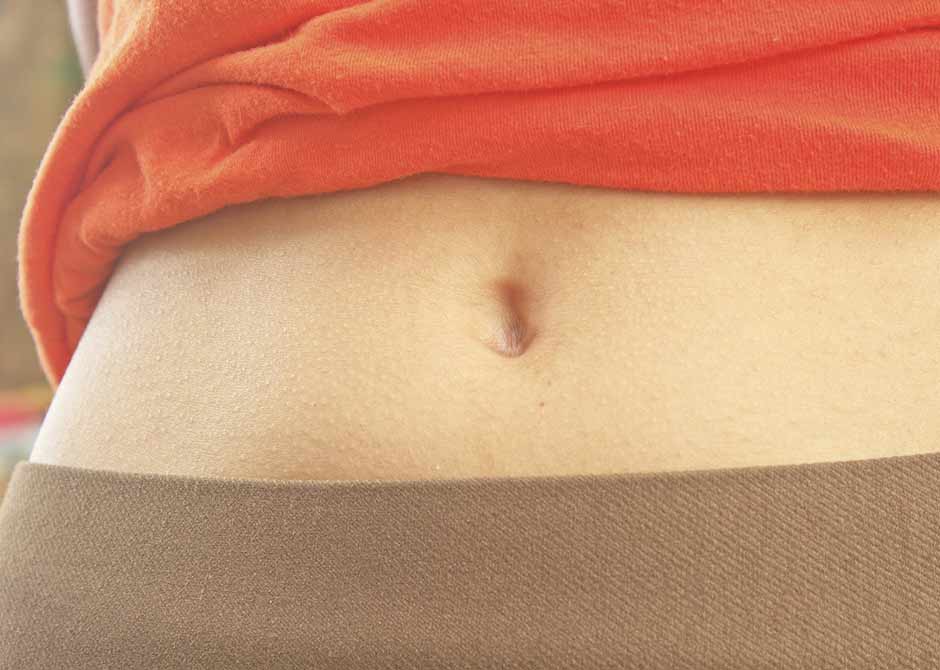 Tummy Tuck