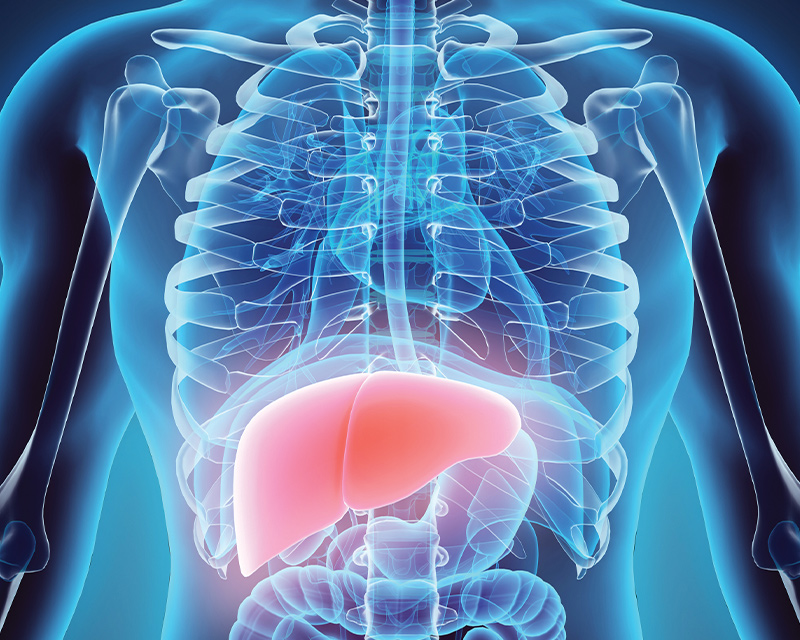 liver transplant
