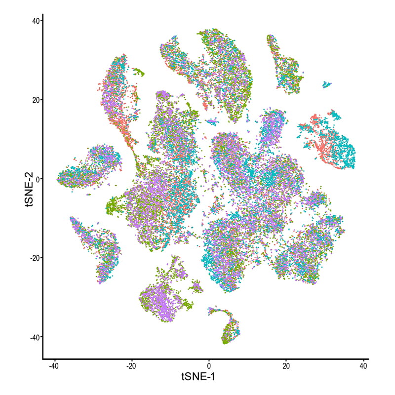 retina graph