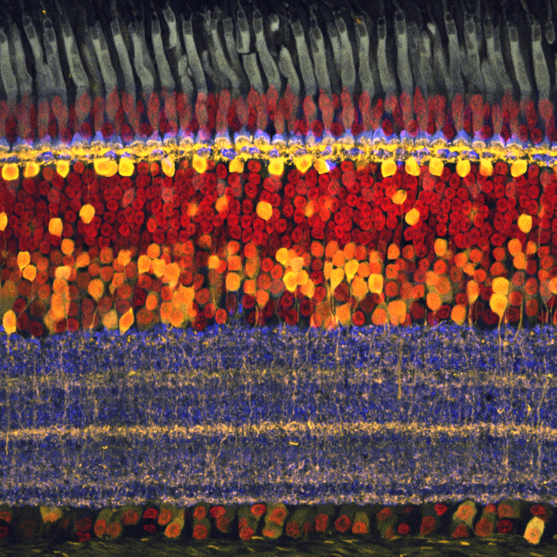 retina under microscope